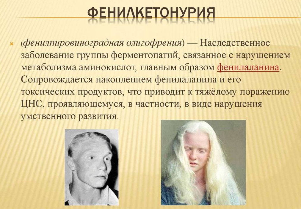 Установлена мера социальной поддержки больных фенилкетонурией в виде выплаты денежной компенсации расходов на приобретение низкобелковых продуктов питания