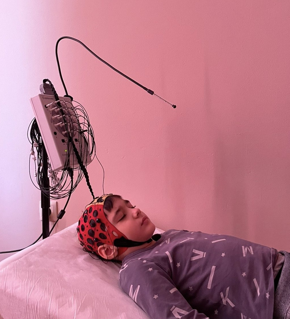 Электроэнцефалография головного мозга (ЭЭГ)