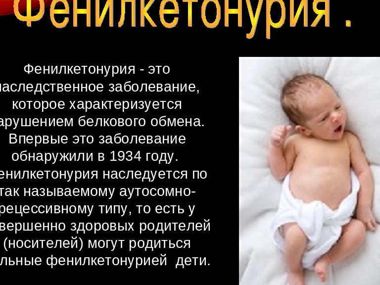 Постановлением Правительства Республики Дагестан установлена мера социальной поддержки детей с диагнозом «фенилкетонурия»