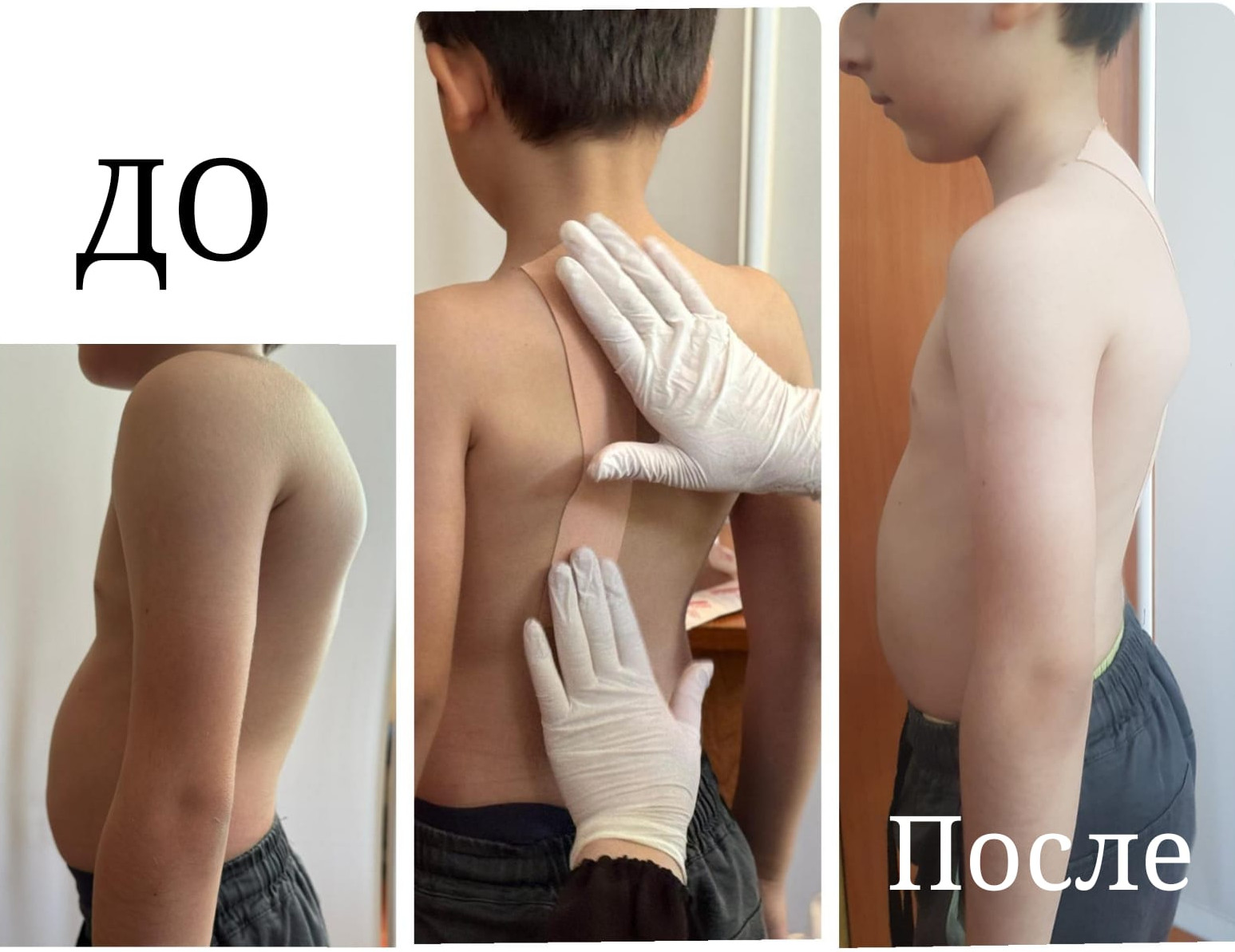 Тейпирование: что это такое и какой эффект можно получить?  Чтобы лучше понять, что такое тейпирование, мы провели занятие для медицинского персонала нашего центра.