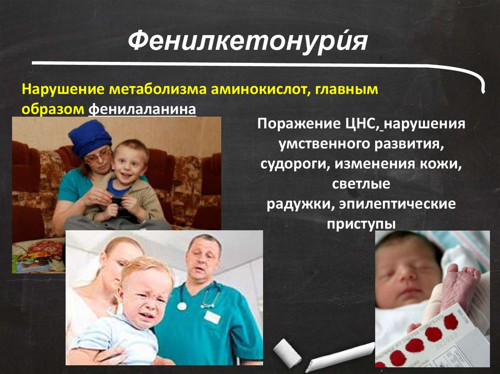 ГКУ РД  УСЗН в МО «Тарумовский район» информирует население района «О мерах социальной поддержки больных фенилкетонурией»  постановление Правительства РД от 8 февраля 2024г. №16