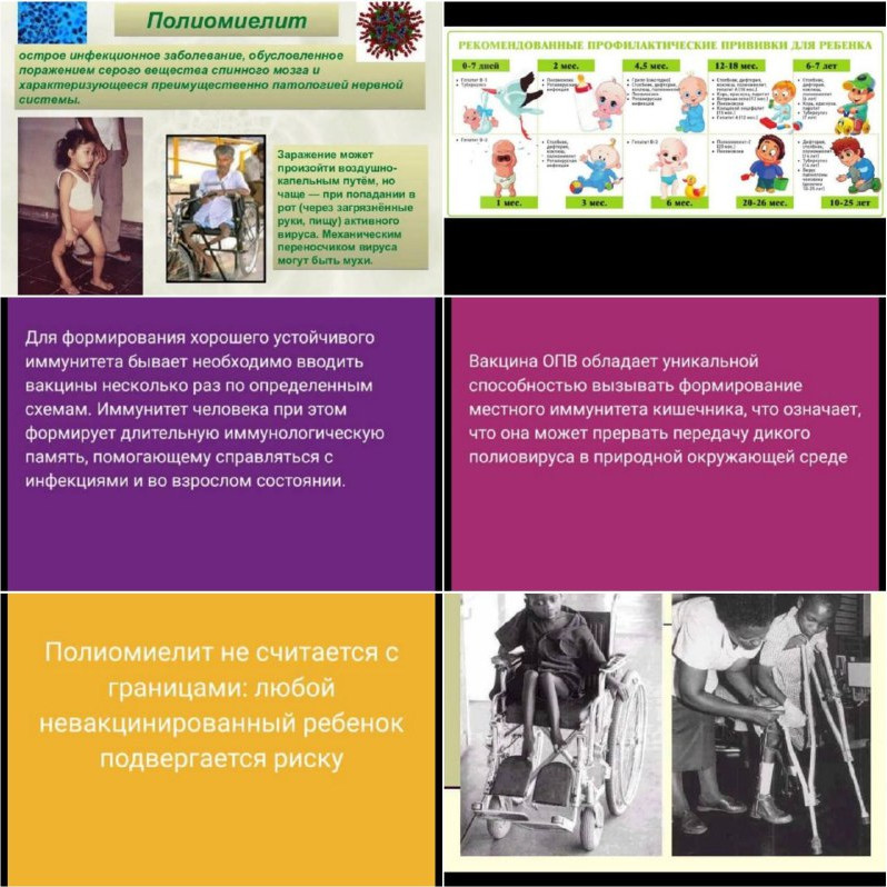Полиомиелит.