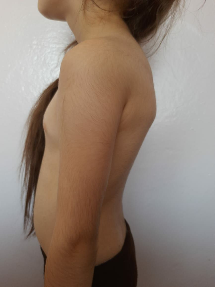 Массаж спины при сутулости