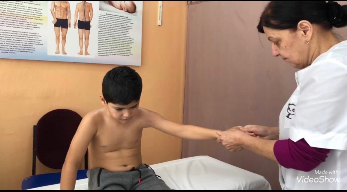 Парез  Дюшена-Эрба